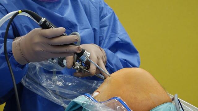 West China Hospital Bone Bank Hip Revision