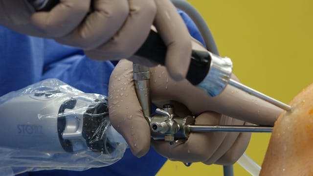 Laparoscopic Surgery Procedure